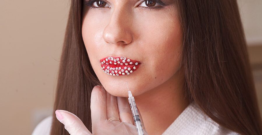 Естетско зголемување и корекција на усните со помош на филери